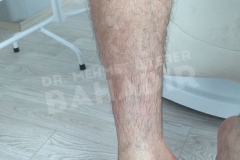 Nach der Behandlung