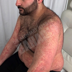 Пациент Ibrahim T.