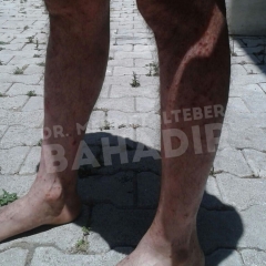 Пациент Ali B.