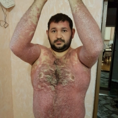 Пациент Inkilab Memedov