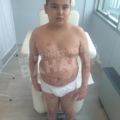 Пациент Mehmet Kalkan