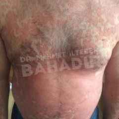 Пациент Metin B.